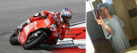 Ducati, intervento chirurgico al carpale della mano per Nicky Hayden